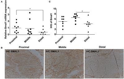 Bmal1 Downregulation Worsens Critical Limb Ischemia by Promoting Inflammation and Impairing Angiogenesis